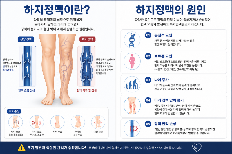하지정맥류, 방치하면 안 되는 이유 — 마사지와 생활습관으로 관리하는 법 | 여수 웅천