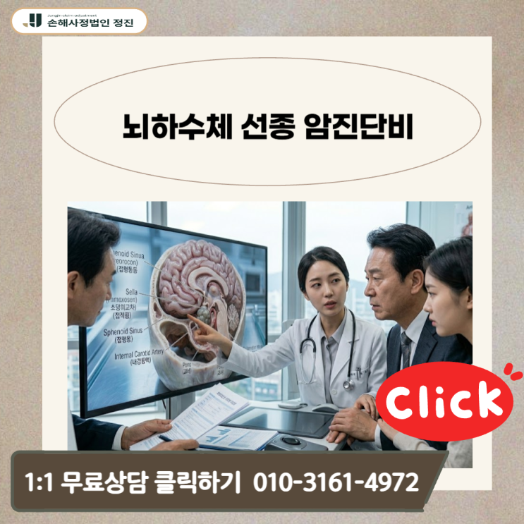  뇌하수체 선종 암진단비, D코드 양성 진단서로 8천만 원 수령한 실무 비결