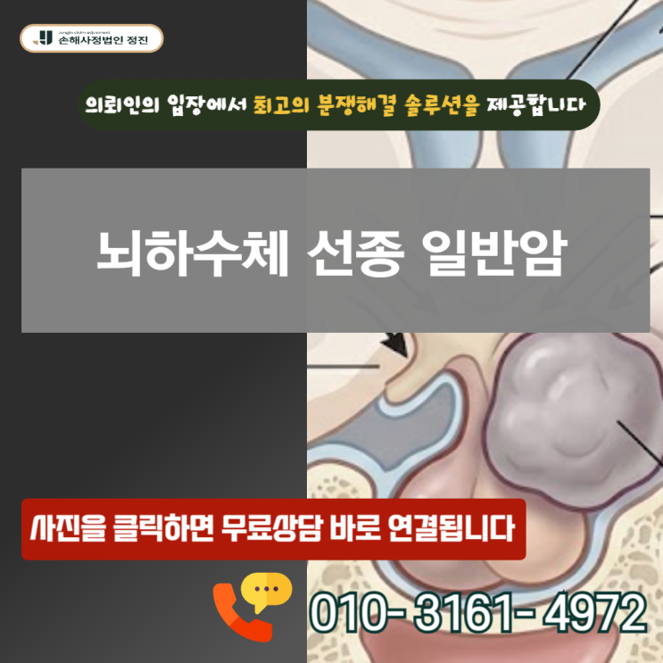  뇌하수체 선종 일반암, D35.2 코드가 0원에서 8천만 원으로 뒤바뀐 손해사정 실전 증명서