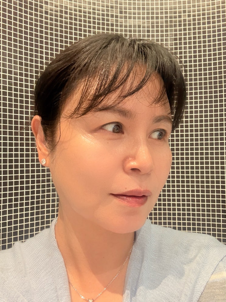  울쎄라 600샷 효과 후기, 수면마취로 피부과 시술 종류 가격 고민 끝