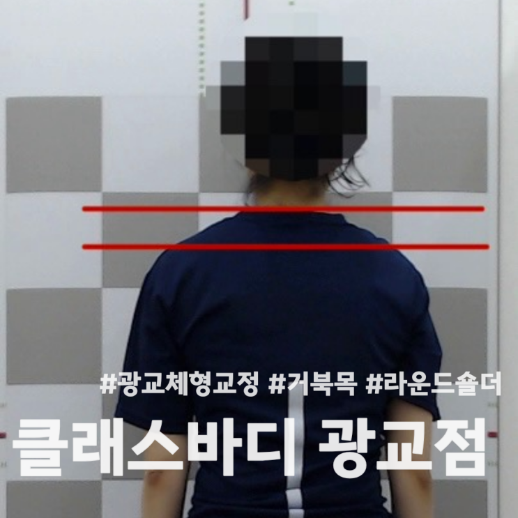  망포피티/광교체형교정 거북목 라운드숄더로 클래스바디에서 체형교정 받고 온 후기