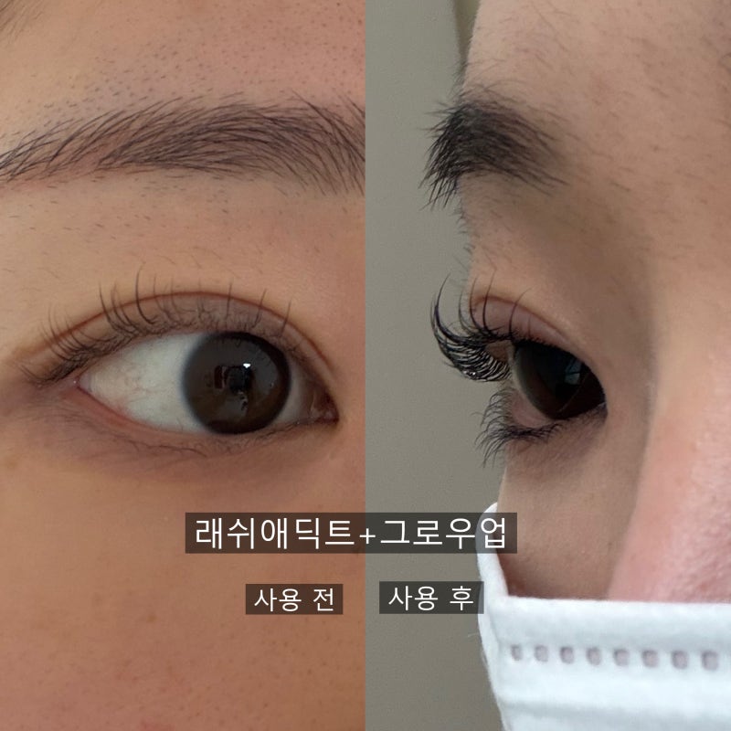 속눈썹 생장제 추천 2탄!!(생장제 끝판왕 래쉬애딕트 찐후기,그로우업 영양제 후기, 속눈썹 ....