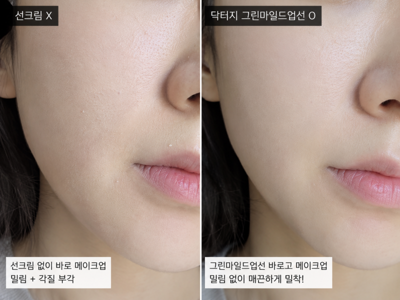 닥터지 선크림 후기: 화장 밀림 없는 여름용 무기자차 (그린마일드업)