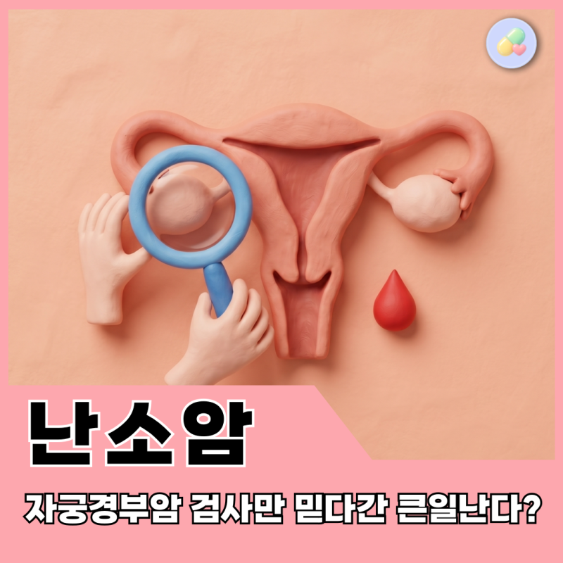 난소암, 자궁경부암 검사로 확인 안 된다? 초음파와 CA-125 피검사 진실