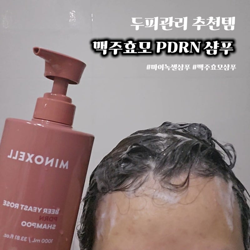 두피관리 시작하면서 바꿔본 마이녹셀 샴푸 맥주효모 PDRN 샴푸