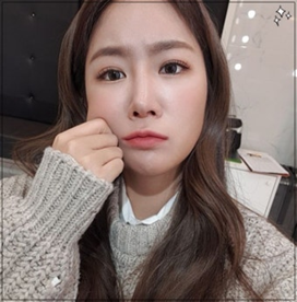 “뮤비 찍다 응급실行” 에스컬레이터 추락 사고에도 끝까지 촬영한 소유의 프로 정신.jpg