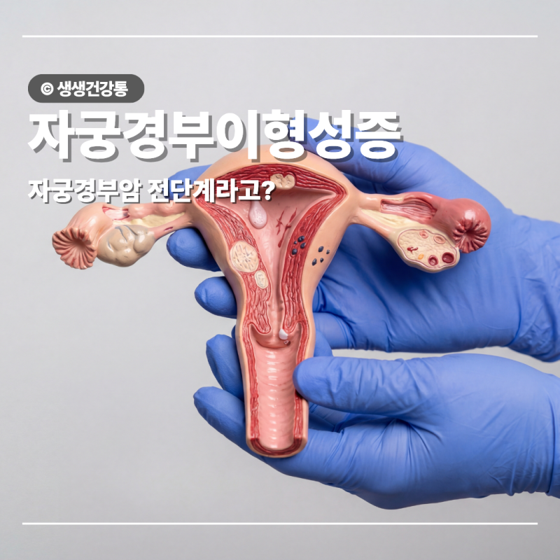 자궁경부이형성증 원인 증상 치료 방법 자궁경부암 전단계?