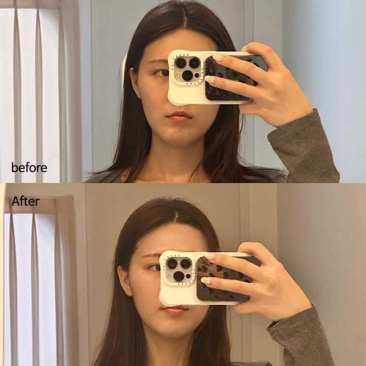  신중동역 신부관리 추천 에스테티아 윤곽관리 후기