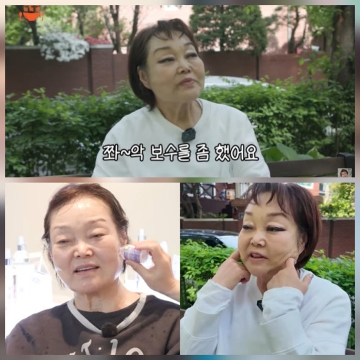 빅마마 이혜정 시술 비포 에프터 근황 나이