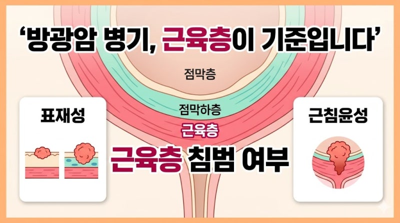 방광암 병기, 표재성·근침윤성 차이 쉽게 정리