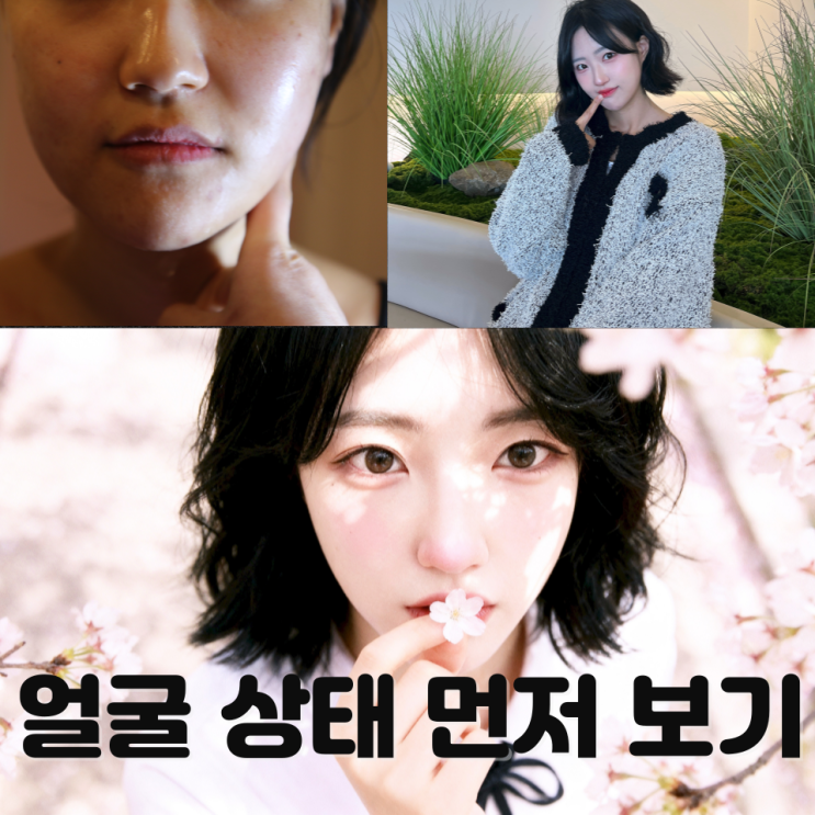 붓기있는 얼굴 보톡스 후 윤곽관리 바로 받아도 될까? 천안 신부동 윤곽관리