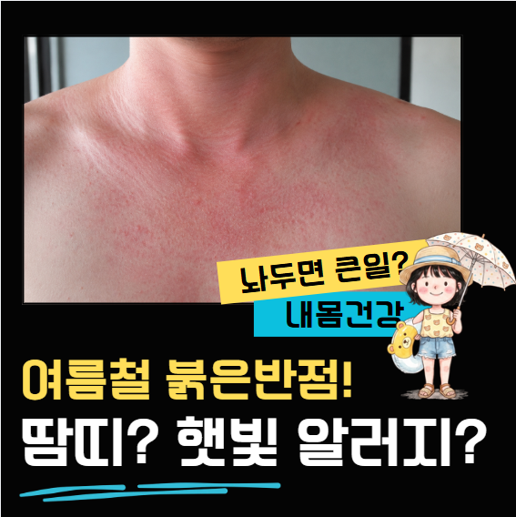 땀 흘린 뒤 가려운 반점, 땀띠일까 햇빛 알레르기일까? (결정적 구별법)