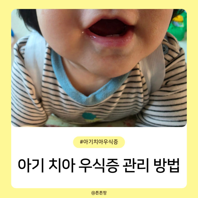 아기 치아 우식증 뜻 원인 증상 및 관리 방법은 바로 이것!