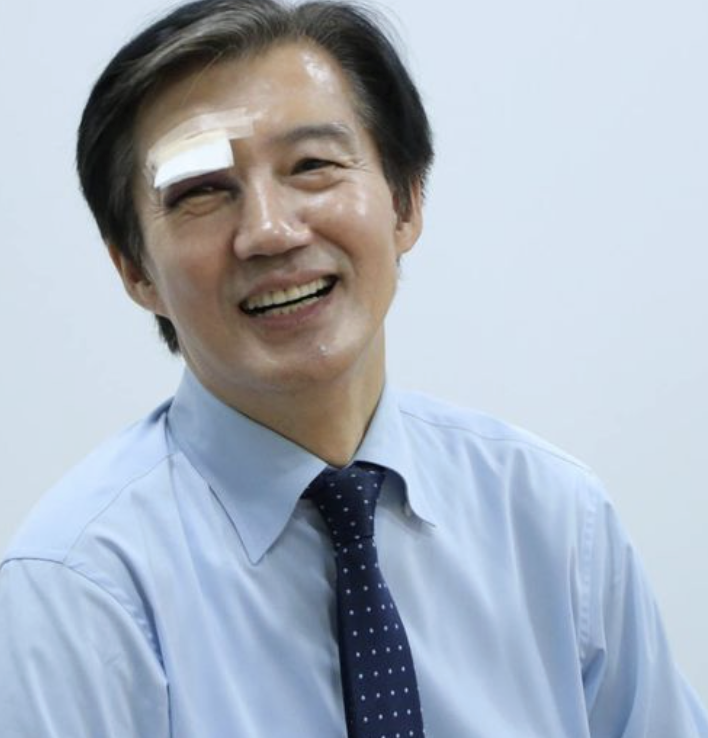 <b>조국</b> 눈가 멍 부상 이유 블랙아이클럽 루머?