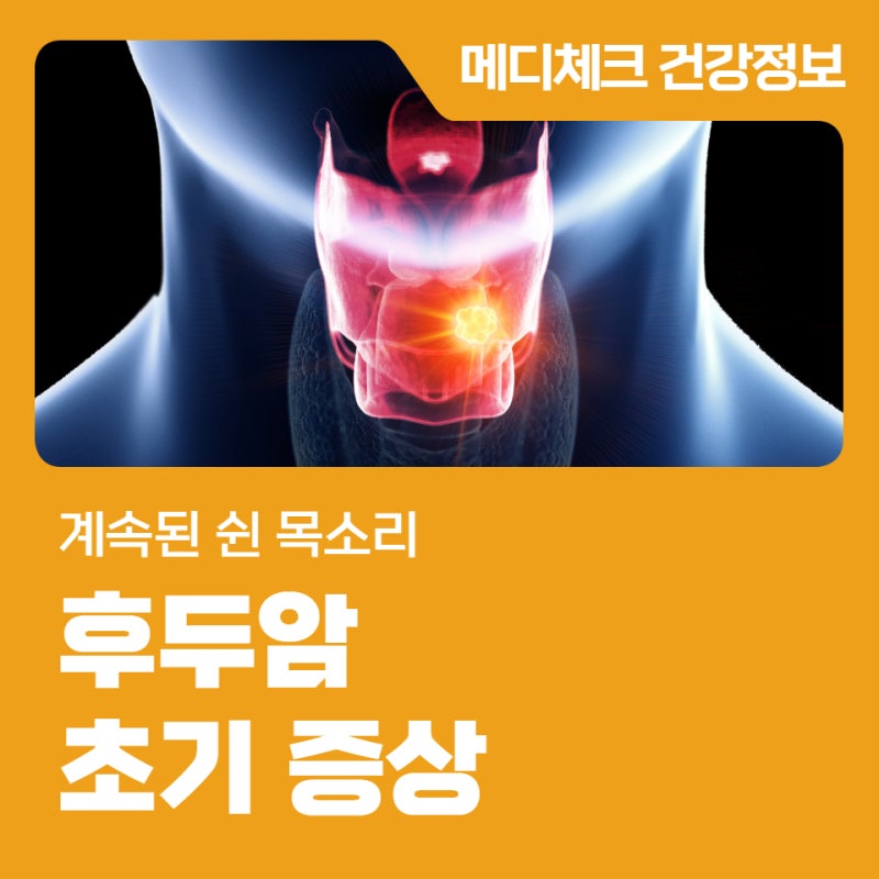 계속되는 쉰 목소리, 후두암 초기 증상