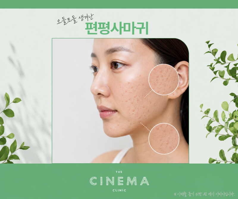 편평사마귀 원인? CO₂레이저 치료·전염·재발까지 정리