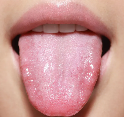 “혀는 어떻게 단맛과 쓴맛을 구별할까, 미각의 원리는 생각보다 놀랍다?”
