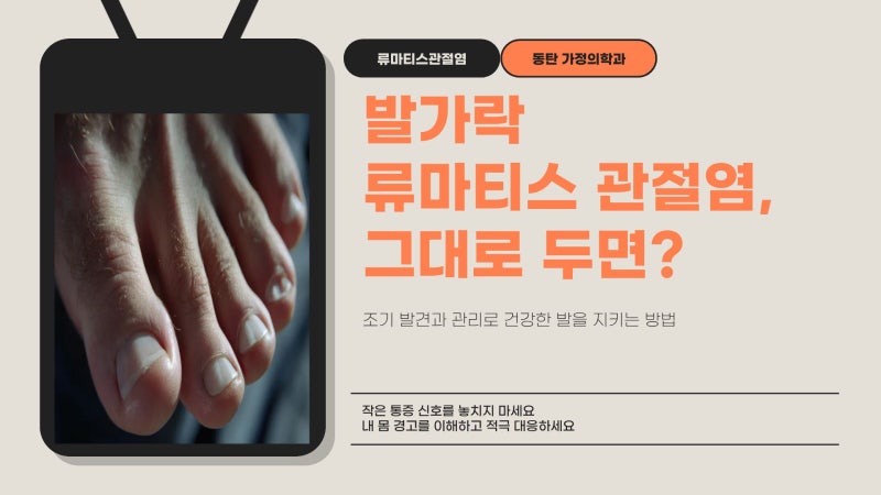 동탄 발가락 류마티스 관절염, 그냥 두면 어떻게 될까요?[가정의학과]
