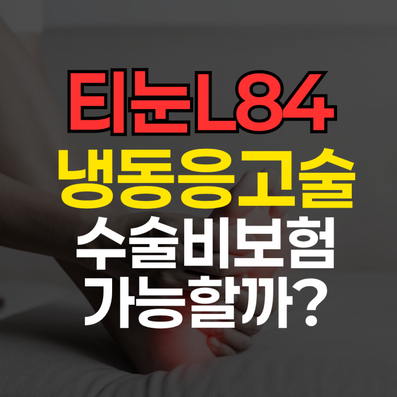 티눈L84 냉동응고술 수술비 보험가능? 최신판결로 정리!
