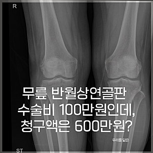 반월상연골판 수술 비용 600만 원? 수술비보다 무서운 비급여 체크리스트