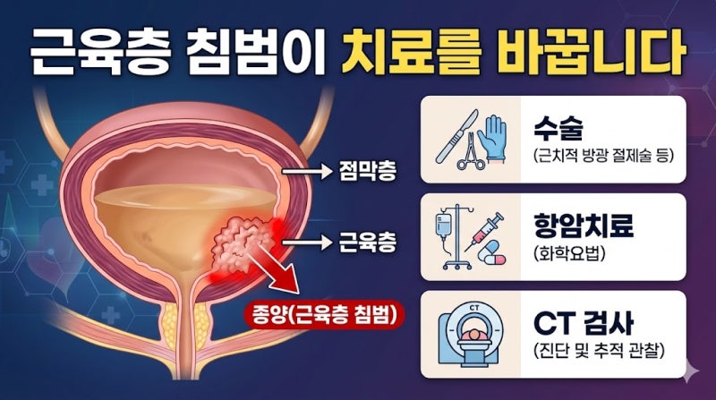 근침윤성 방광암, 치료 방향이 달라지는 이유