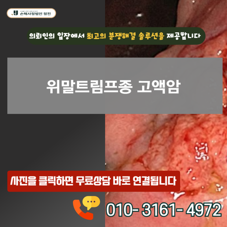  위말트림프종 고액암, C88.4 코드를 받고도 일반암 지급에 그치는 숨겨진 이유와 해결책