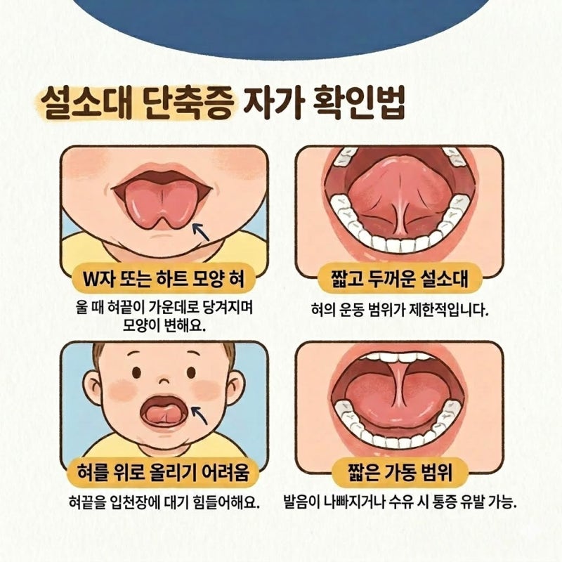 우리 아이 하트 모양 혀?설소대 단축증 증상과 혀모양 확인법, 수술 시기 및 실비 비용 총정....