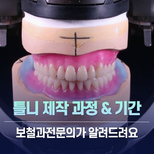 틀니 제작은 어떻게 진행될까요? 단계별 설명