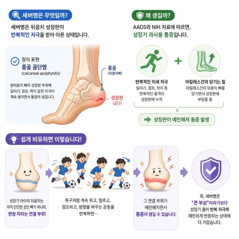 축구하는 아이 뒤꿈치 통증, 세버병일까?