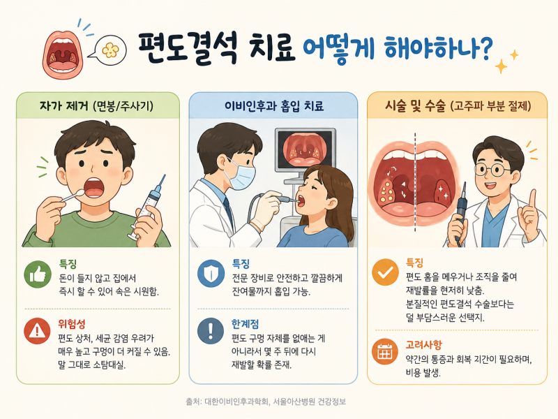 편도결석 치료 자연스럽게 빠지기도 하나요? 냄새 나는데 수술 없이 해결하는 법