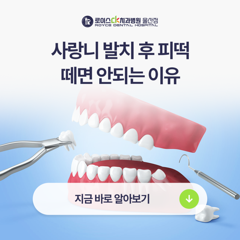 사랑니 발치 후 피떡, 억지로 떼면 안 되는 이유