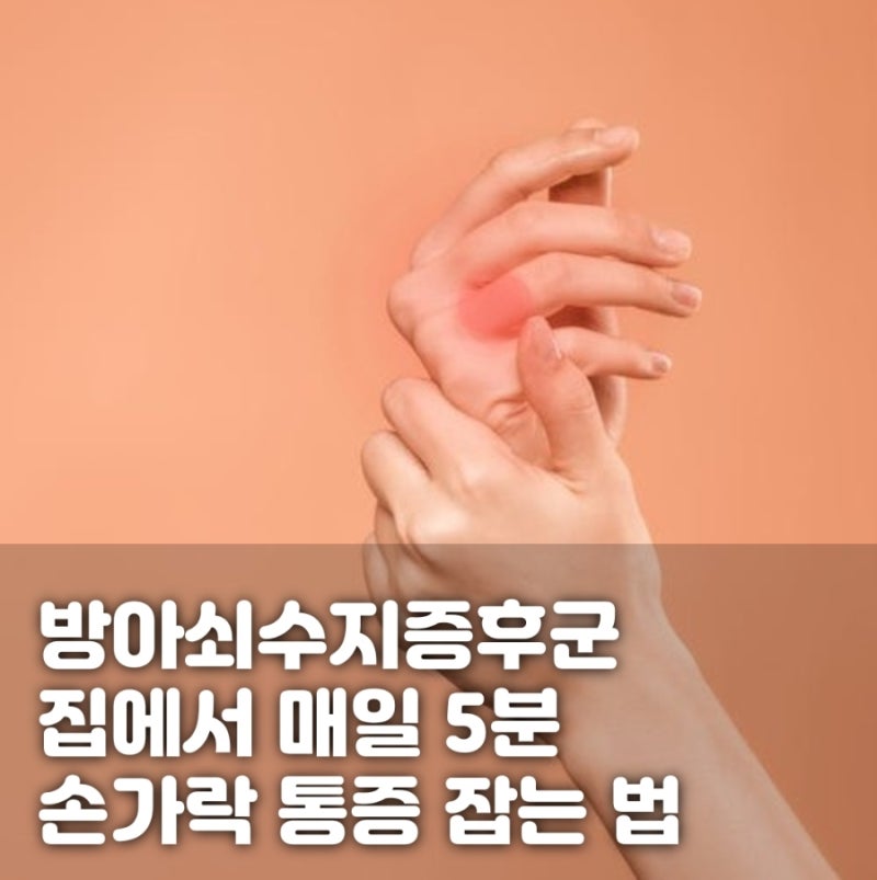 방아쇠수지증후군 스트레칭, 집에서 매일 5분 손가락 통증 잡는 법