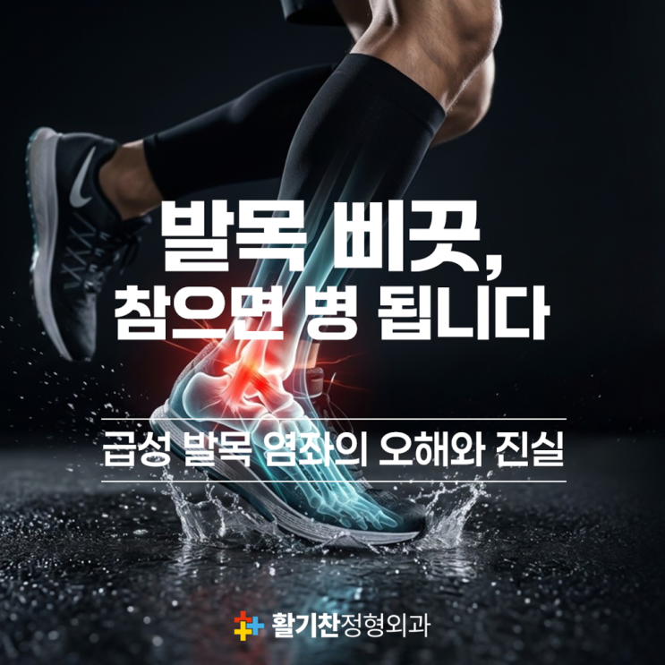  급성 발목 염좌, 초기 RICE 응급처치부터 재활까지
