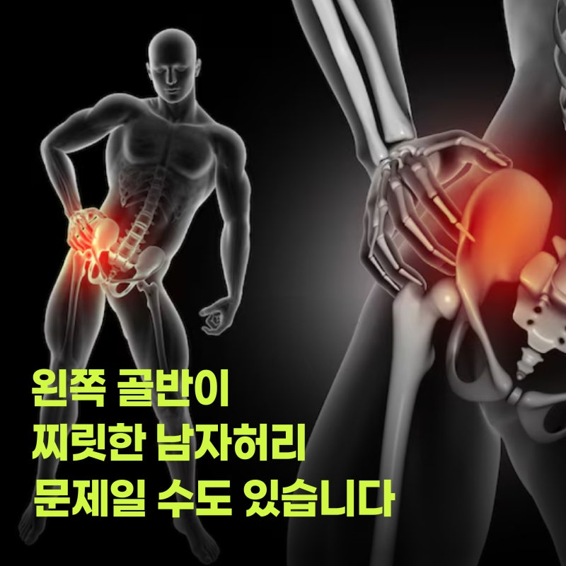 왼쪽 골반이 찌릿한 남자허리 문제일 수도 있습니다