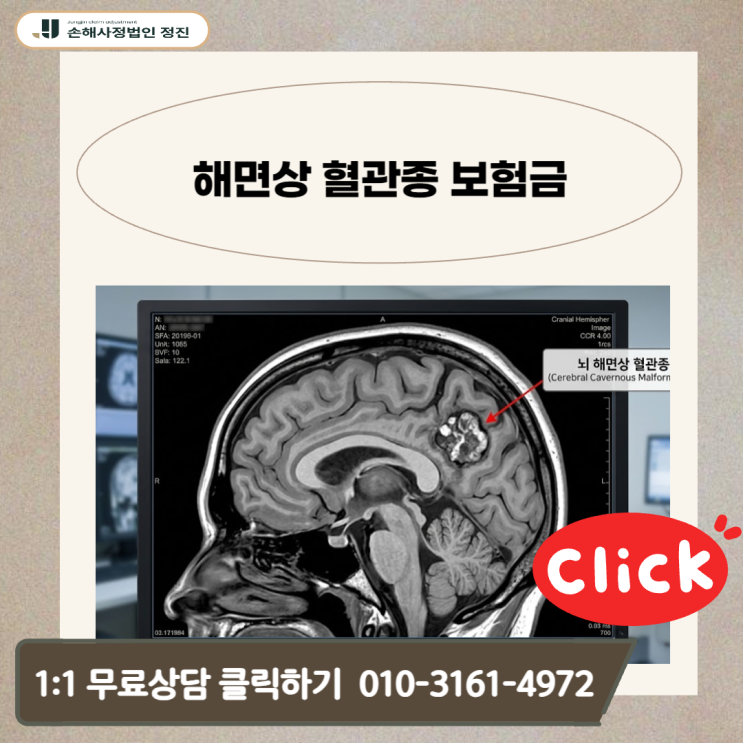  해면상 혈관종 보험금, 진단서 한 장에 숨겨진 5천만 원의 진실을 밝힙니다