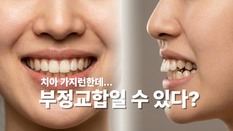 용인 교정치과 부정교합 종류 6가지 총정리, 치아가 가지런해도 교정이 필요하다고?