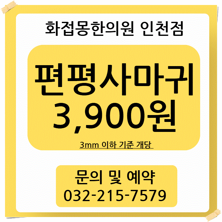 번지기 쉬운 편평사마귀, 빠른 관리가 중요한 이유 / 인천 미추홀구 문학동 편평사마귀 제거