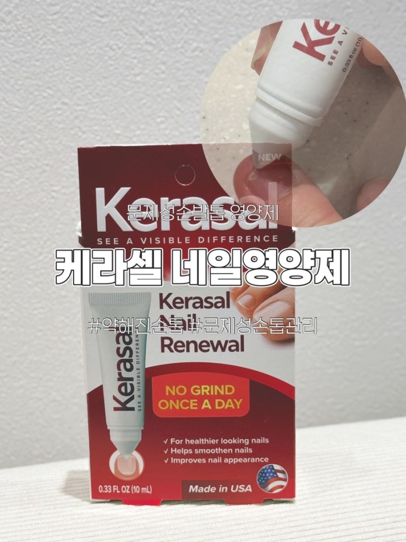 케라셀네일문제성손발톱 영양제 하나로 관리 끝!