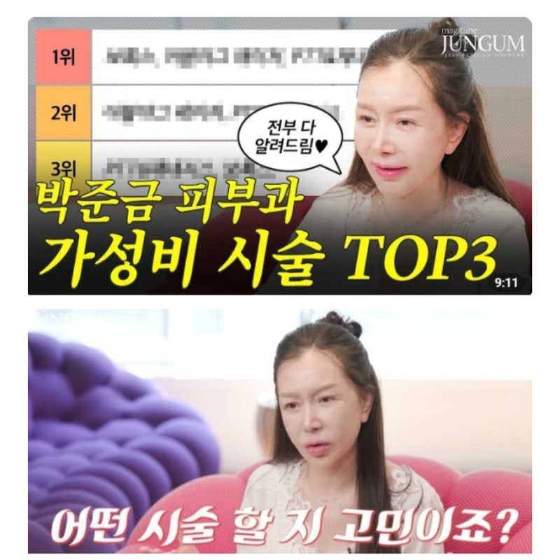 박준금 63세에 이 피부?! "박준금이 직접 공개한 '가성비 피부과 시술' 전부 다 알려드림"