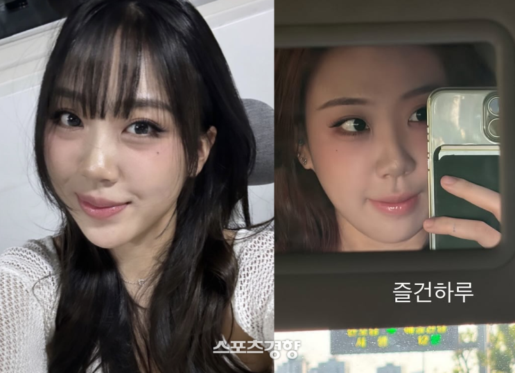 연예인뿐만 아니라 일반인들도 많이 한다는 눈밑지방 재배치, 정확히 뭘까? 성형외과 의사가 설명해줌 이정돈 보고 상담가자.