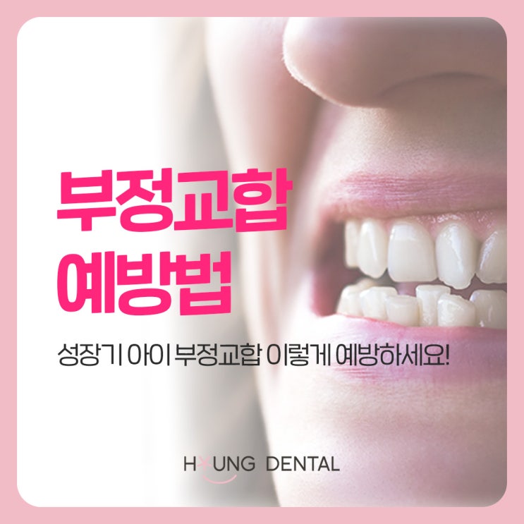  망포역 소아치과가 말하는 부정교합 예방 방법