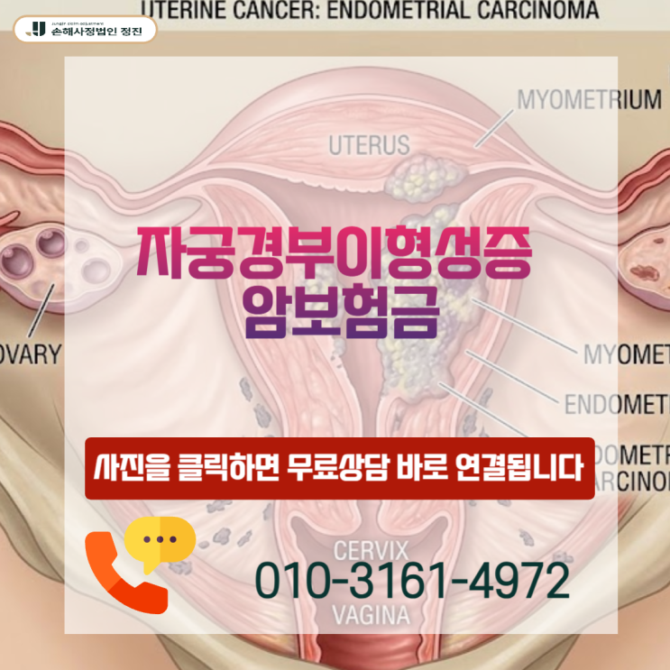  자궁경부이형성증 암보험금, N87 코드라며 거절당한 분들을 위한 손해사정사의 솔직한 고백