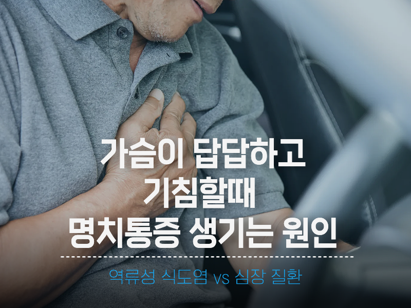 갑자기 가슴이 답답하고 기침할때 명치 통증 생기는 원인 (역류성 식도염 vs 심장 질환)