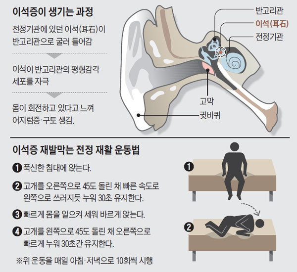  이석증 증상 원인 재발방지 예방 차원 영양제까지 완전 정복 가이드