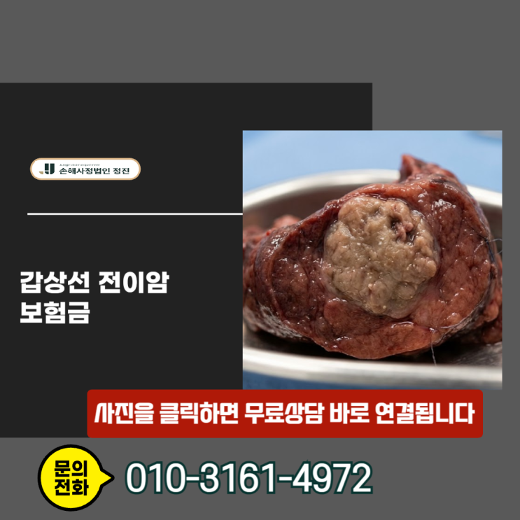  갑상선 전이암 보험금, 거대 보험사의 함정 약관을 깨부수고 전액 수령한 실전 노하우