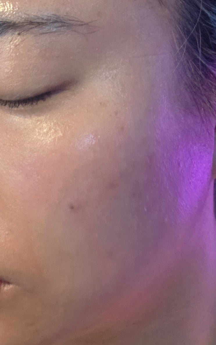  홍대 화이트태닝 아이러브탠 홍대점, 10회 후기 하얘짐+피부재생 미쳤어요!