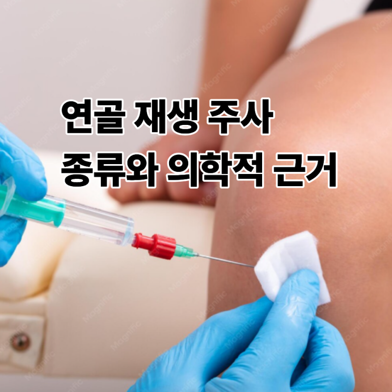 연골 재생 주사 종류와 의학적 근거 팩트 체크