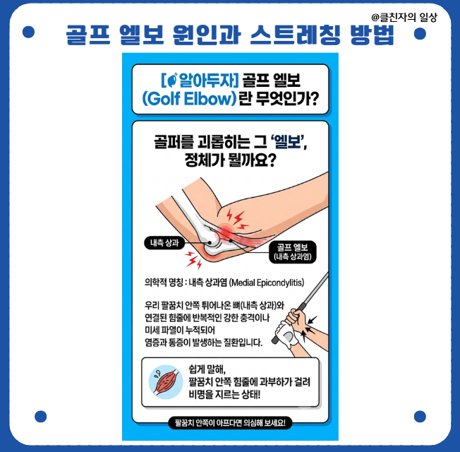 골프 엘보 원인과 통증 완화 스트레칭법: 팔꿈치 통증 싹 잡고 라베 달성하기