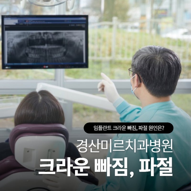 임당역치과 임플란트 크라운 빠짐, 파절 원인은?