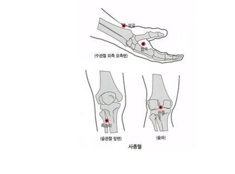 사총혈 : 네이버 블로그